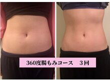 モモ 三ノ宮店(momo)/デトックスできる身体へ☆