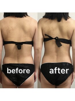 ベルフィーヌ 北千住店(BELFINE)/充実コースビフォーアフター