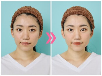 スピード小顔 渋谷店 (Speed)/体験ビフォーアフター