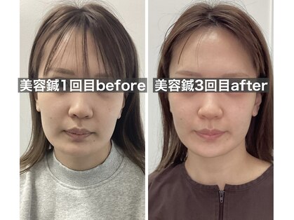 ハリサロンドオフ 堺東店(hari salon de off)の写真