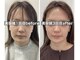 ハリサロンドオフ 堺東店(hari salon de off)の写真