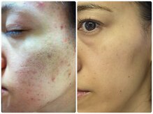 リコ(Lico)/以前のオーナー自身