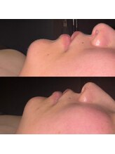 シノ 銀座(shino)/ツルピカたまご肌☆