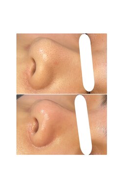 プリュベル(+belle)/◇お客様before after◇