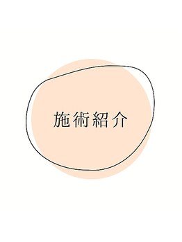 フューチャー(Future)/施術紹介