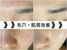 【肌質改善】人気ノーファンデ肌フェイシャルで40代の肌育成！