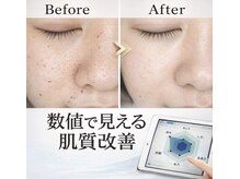 ビーエックス(.BX)