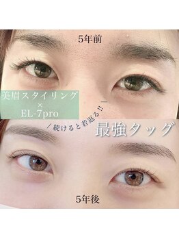 アルテ アイアンドビューティー(Arte eye&beauty)/美眉スタイリング×目元美顔器