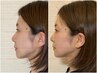人気NO1【たるみ疲れ顏改善】首肩から引き上げるリフトケア+深眠ヘッドスパ