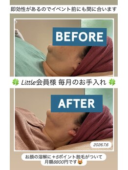 ヴォアール 東静岡店(VOIR)/little会員様　BeforeAfter
