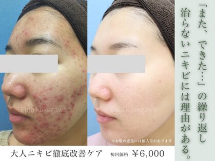 フェイシャル専門店 エピア 掛川店(Epia)の写真