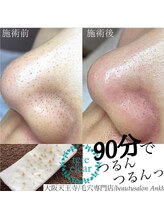 アンク(Ankh)/90分で毛穴も肌もつるんつるんっ