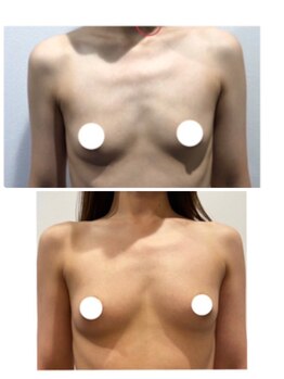 フラフィ 宇都宮本店(fluffy)/お客様症例☆40代