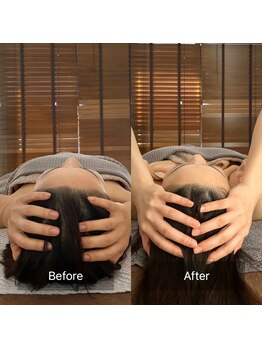 サロンツキ(salon tuki)/【ドライヘッドスパ】症例★