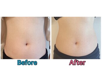 シロ チューズミー(Shiro choose me)/ボディーメニューも♪