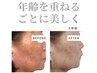 【年齢肌対策】シミ・くすみ・たるみ・色ムラ改善