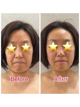 アンドスール(&soeur)/10歳若く見えて嬉しいです！