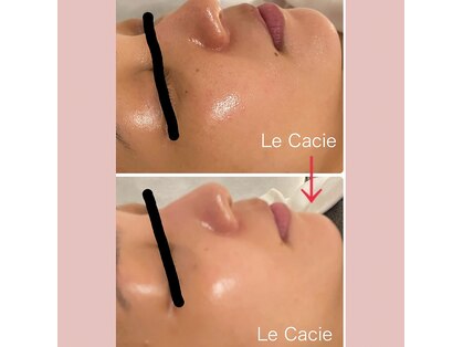 ルカシエ(Le Cacie)の写真