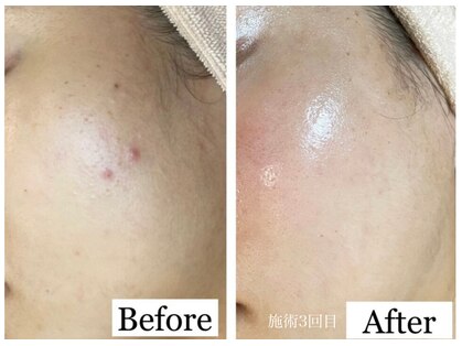 オリエンタルビューティー(ORIENTAL BEAUTY)の写真