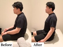 ソレア(Solea)/肩こり・巻き肩改善1回目