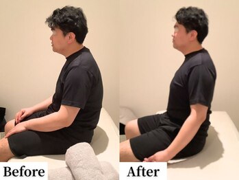 ソレア(Solea)/肩こり・巻き肩改善1回目