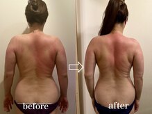 フィス エステティックサロン/痩身／ダイエット/サイズダウン