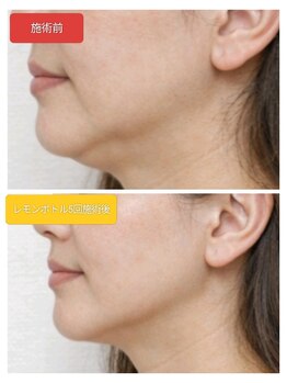 縁(en)/レモンボトル5回♪