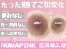 ライリー(Rairy)/【黒ずみ◎】ROMAPINK