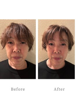 アユナタ(Ayu Natah)/目元フェイスラインリフトアップ