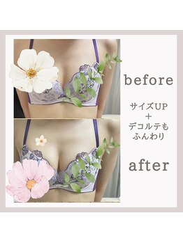 アリサナ(Arisana)/症例写真 バスト 葛西