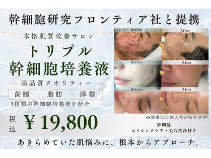 エンムーン バイ ケアナ(Enmoon by CareNa)の写真