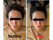 アコルデ(Acorde)/コルギ×エステ×石膏パック