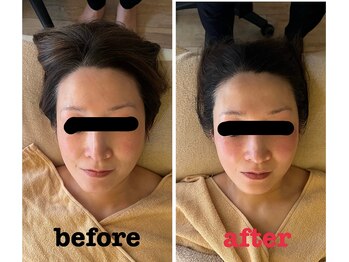 アコルデ(Acorde)/コルギ×エステ×石膏パック