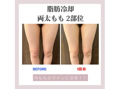 クリーンビューティーメディカルサロン(CLEAN BEAUTY Medical Salon)の写真