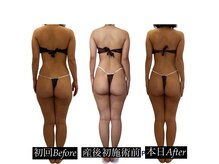 ロハスプラスアール(LOHAS+R)の雰囲気（チノザメソッド／産後も体型維持。施術6回。不調も改善。）