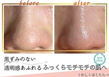 リエラ(Liella)
