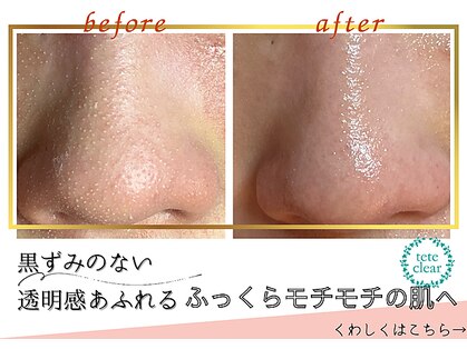 リエラ(Liella)の写真