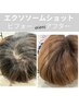 【頭皮改善】3種のエクソソーム導入！広範囲の方はこちら！49500円→44000円