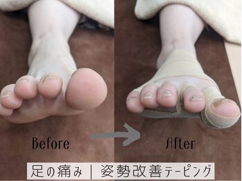 グランツ(glanz)/足の痛み|距骨から整える足整体