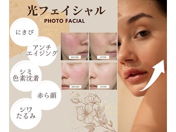 アフロディーテ(Aphrodite)の写真/くシワ・たるみ・ニキビなどが気になる方へ】光フェイシャルで美白&エイジングケア◎