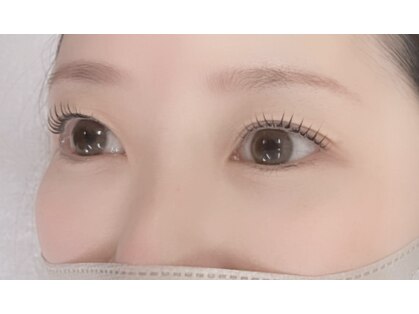 オミィ(OMIy)の写真