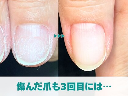 キラリネイル(KIRARINAIL)の写真