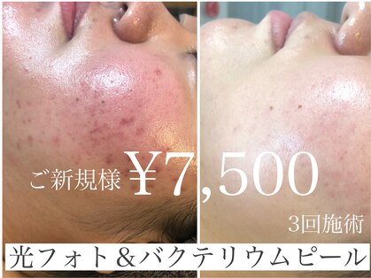 グレイティア(gratia)の写真