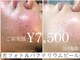 グレイティア(gratia)の写真