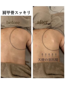 ビアージュ ナガクテ(Beage nagakute)/背中ケアはお任せください