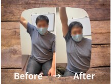 整体院プリュ/Before→ After［6］