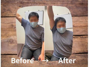 整体院プリュ/Before→ After［6］