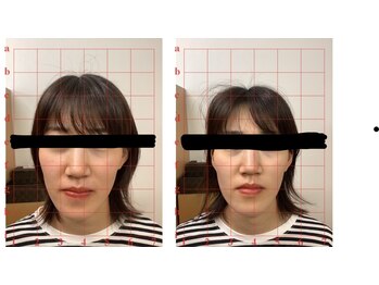 田端整体院/あごがすっきり小顔整体