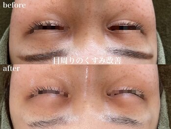 リボーン 浜松(reborn)/