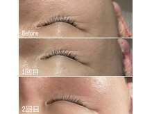 コルギ デ コガオ(KORUGI de KOGAO)/LAMINATION PEEL